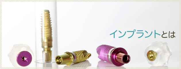インプラントとは
